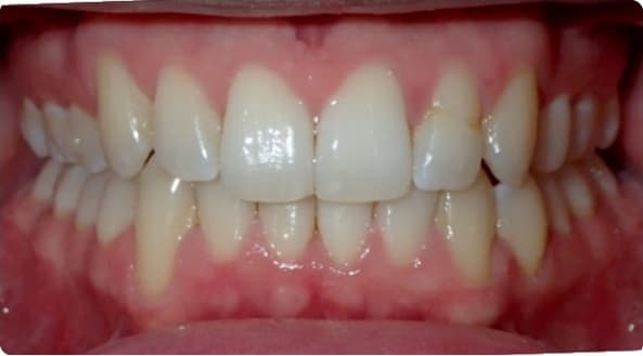 Case 28 after