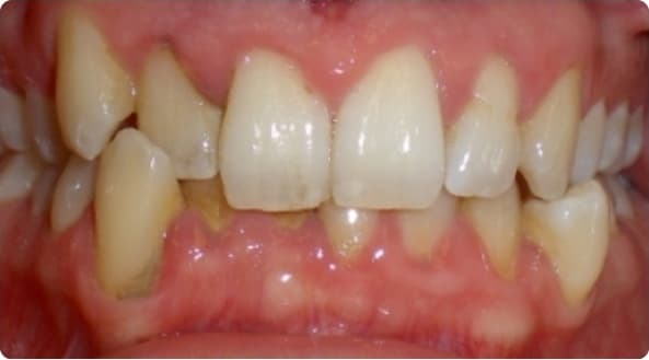 Case 28 before