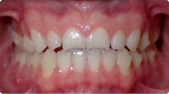 Case 29 before