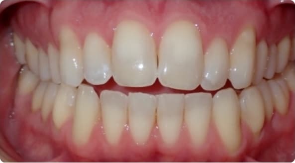 Case 30 before