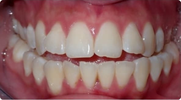 Case 31 before
