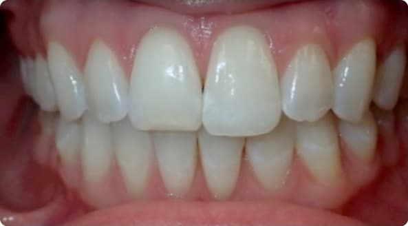 Case 4 before