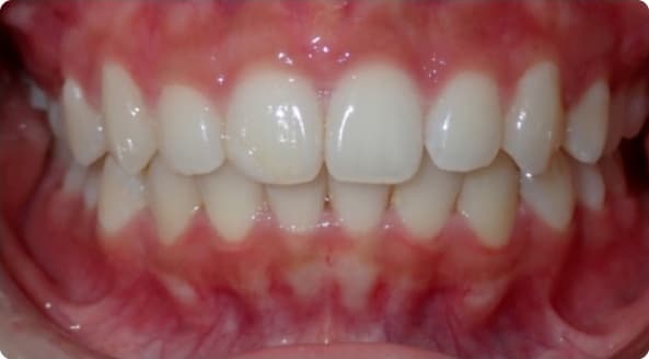Case 5 after