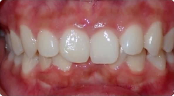 Case 5 before