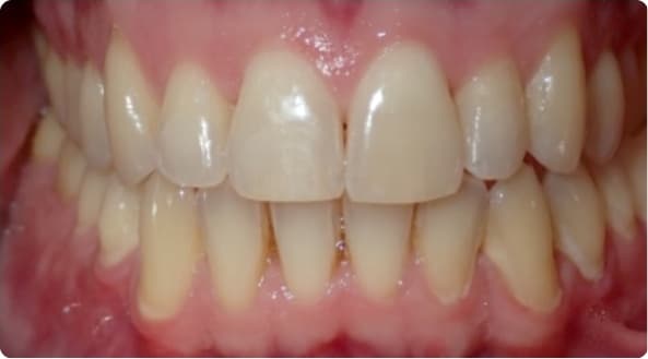 Case 6 after