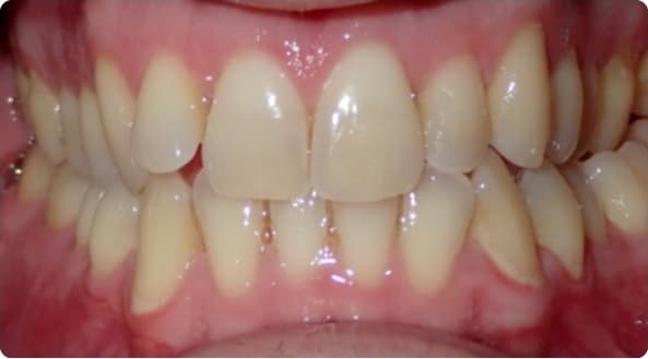 Case 6 before