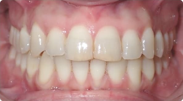 Case 7 after