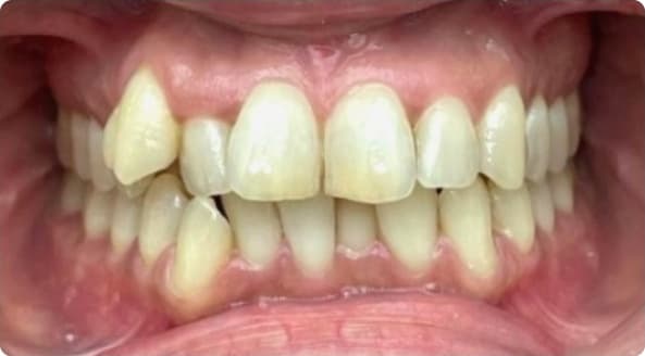 Case 7 before