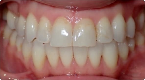 Case 8 after