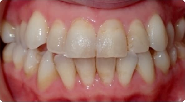 Case 8 before