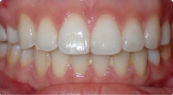 Case 9 after
