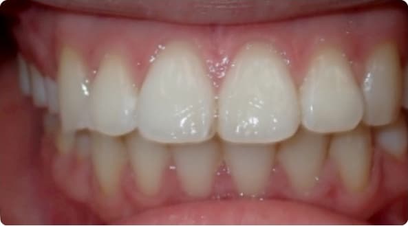Case 9 before
